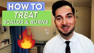 Burns | How To Treat Burns | How To Treat A Burn