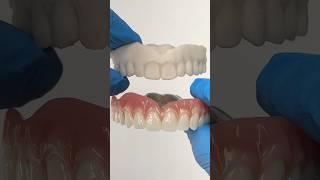 Before and After Chrome Cobalt Denture #lsk121shorts #dentist #teeth