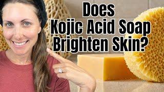 Dark Spot Remover? Adding Kojic Acid Soap to my Skincare Routine