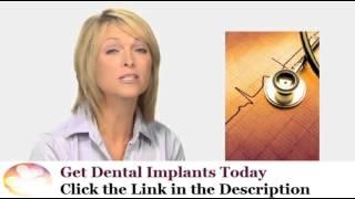 San Diego Dental Implants California #1 in Best Cosmetic Dentistry