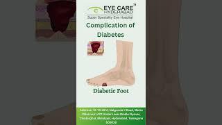 Complications of Diabetes: Eye Care in Hyderabad | Retina Specialist | Eye Hospital