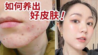 「拯救烂脸秘笈大公开！」我的精简护肤Routine | Skincare Routine 痘痘肌变水光肌的秘密