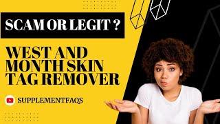 West and Month Skin Tag Remover Reviews and Warning - Watch Before Buying!