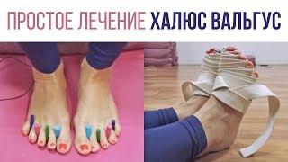 Халюс Вальгус – Лечение без операций в домашних условиях!