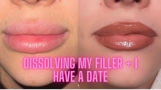 DISSOLVING MY LIP FILLER + MY DATE AT A 2 MICHELIN STAR RESTAURANT   | VLOG | HOLLY SCARFONE