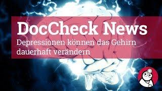 Depressionen können das Gehirn dauerhaft verändern