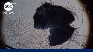 2 Chinese nationals charged with smuggling dangerous fungus into US