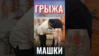 Упражнения для грыжи позвоночника/ Грыжа машки