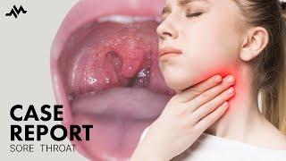 Sore throat and painful swallowing - Case Report