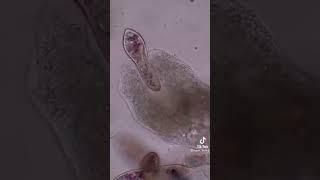 Амёба-тёмные силы, Инфузория-ТОПЧИК