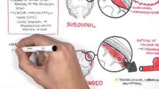 Intracranial Haemorrhage Types, signs and symptoms