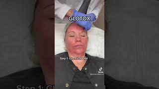 GloTox - Chemical Peel & Botox