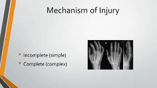 MCP Joint Dislocation