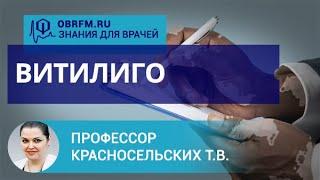 Профессор Красносельских Т.В.: Витилиго