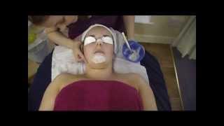 Beauty Specialist Extractions with Scaling Fluid