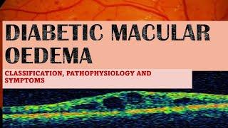 DIABETIC MACULAR EDEMA made incredibly easy !!