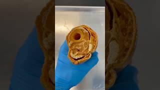 Looking At a Cut Through the Lower Leg