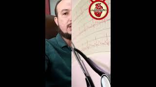 أهمية رسم القلب في تشخيص جلطات القلب المكتملة
