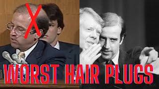 Joe Biden Worst Hair Plugs in History