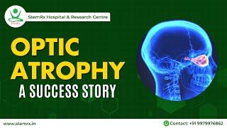 From Darkness to Light: StemRx Bioscience Solutions Restored Sight Against Optic Atrophy