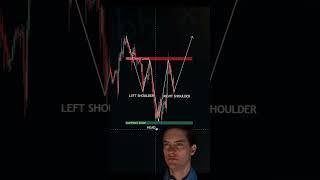 Options Trading  //#trading #goldscalping #goldinvestment #stockmarket #bigtrade #forex