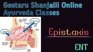 Epistaxis by Geetaru Shanjalii online Ayurveda Classes BAMS shalakyatantra ENT lectures