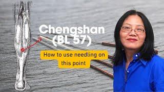 How to needle acupoint Chengshan (BL 57) in Chinese Medicine? | Principles on the depth of needling