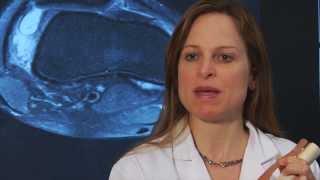 Dr. Sabrina Strickland explains Patellar Dislocation and MPFL Reconstruction