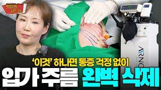 입가주름 이제 30분이면 없앨 수 있습니다, 비수면 마취 실리프팅 시술 소개합니다