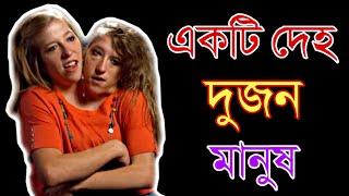৫টি অদ্ভুত মানুষ  | 5 Strangest People in the World in Bengali| Tree Man | Blue Man | AUFT