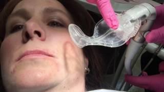 Isolite with Julie Gillis DDS