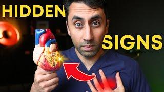 Doctor Explains Heart Attack Symptoms: 7 Warning Signs You Should NEVER Ignore! 🫀️