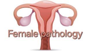 Female pathology 3rd lecture.