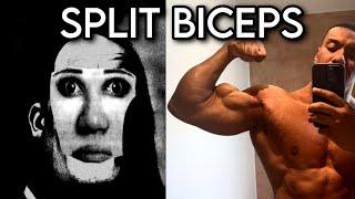 BICEP GENETICS