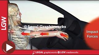 Car Crash Impact on Shoulder 3D Animation