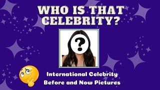 Guess The Pictures | International Celebrities | Trivia Games | Direct Trivia