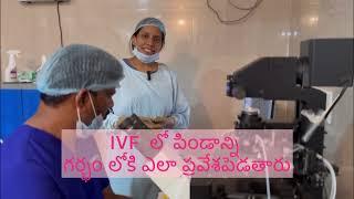IVF LAST STEP EMBRYO TRANSFER