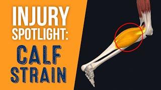 Injury Spotlight: Calf Strain