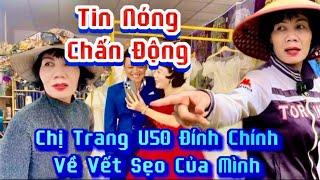 Sự thật về vết sẹo trên khuôn mặt chị trang u50