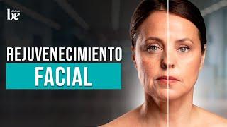 Rejuvenecimiento facial para combatir el envejecimiento | Clínicas Be ‍️ | Dra. América Escandón