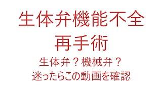 再手術？弁膜症治療、生体弁置換、あまりにも早かった機能不全。再手術決定か？