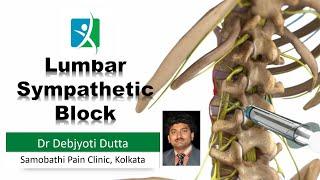 Lumbar Sympathetic Block | Live Demonstration | Samobathi Pain Clinic | Dr. Debjyoti Dutta