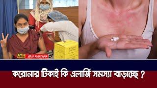 করোনার টিকা বাড়াচ্ছে এলার্জি রোগ, রয়েছে নানা পার্শ্বপ্রতিক্রিয়া | Corona Vaccine Side Effects