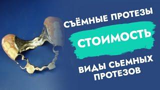 Съёмные протезы. Стоимость. Виды съёмных протезов.