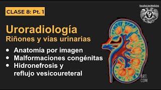 08.1 - Uroradiología - Anatomía por imagen y malformaciones congénitas