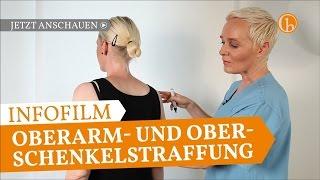 Oberarm- & Oberschenkelstraffung | Erfahrungsbericht | Dr. Simone Hellmann Plastische Chirurgie Köln