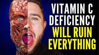 I Took 3g of Vitamin C For 30 Days, Here's What Happened...