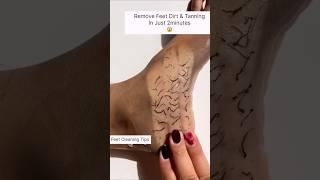 Tips 03 | Get Soft And Smooth Feet Get Rid Of Dry & Dirty Feet, Remove Suntan #shorts#skincare#viral