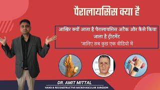 What Is paralysis, symptoms . How does paralysis treated by orthopedic Doctor लकवा क्या है  जाने .