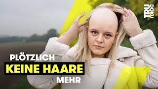 Im Urlaub: Leonie (22) verliert fast alle Haare | TRU DOKU